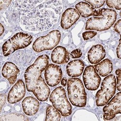 KCTD19 Antibody, Novus Biologicals 0.1mL; Unlabeled:Antibodies, Polyclonal