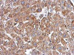 KCTD3 Antibody, Novus Biologicals 0.1mL; Unlabeled:Antibodies, Polyclonal