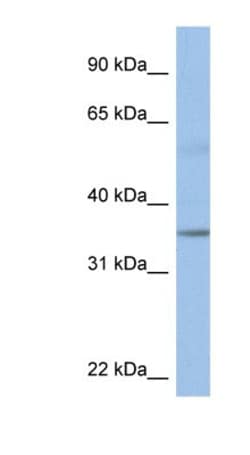 KCTD4 Antibody, Novus Biologicals 100 &mu;L | Buy Online | Novus Biologicals | Fisher Scientific