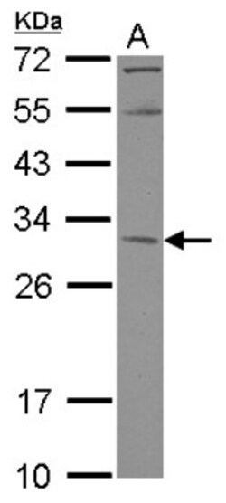 KCTD4 Antibody, Novus Biologicals 0.1mL; Unlabeled:Antibodies, Polyclonal