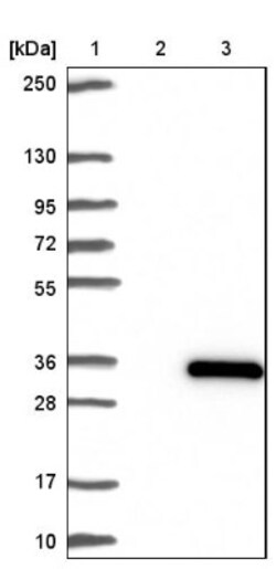 KCTD6 Antibody, Novus Biologicals 0.1mL; Unlabeled:Antibodies, Polyclonal