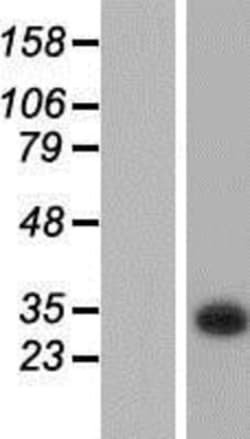 Novus Biologicals&trade;&nbsp;KCTD6 Overexpression Lysate