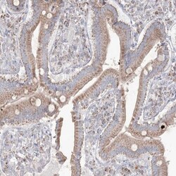 KCTD6 Antibody, Novus Biologicals:Antibodies:Primary Antibodies