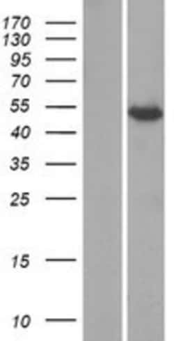 Novus Biologicals&trade;&nbsp;KCTD8 Overexpression Lysate