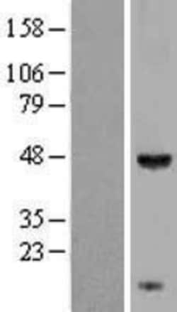 Novus Biologicals™ KCTD9 Overexpression Lysate