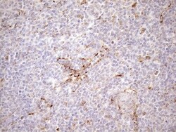 KCTD9 Antibody (OTI2G8), Novus Biologicals 0.1mL; Unlabeled:Antibodies,