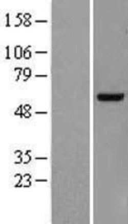 Novus Biologicals™ KDELC2 Overexpression Lysate