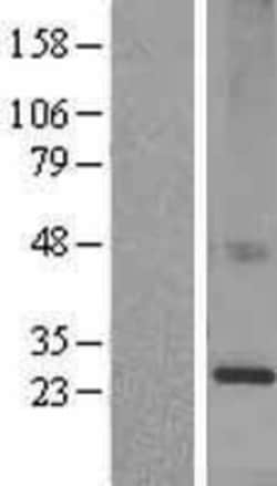Novus Biologicals™ KDELR1 Overexpression Lysate