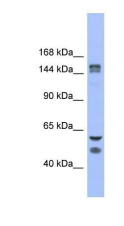 KDM2B Antibody, Novus Biologicals 0.05mg; Unlabeled:Antibodies, Polyclonal