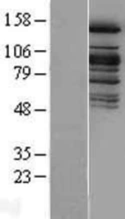 Novus Biologicals&trade;&nbsp;KDM6A Overexpression Lysate