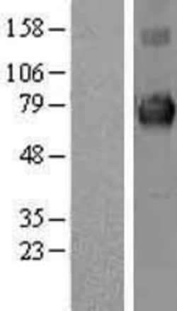 Novus Biologicals&trade;&nbsp;Keap1 Overexpression Lysate