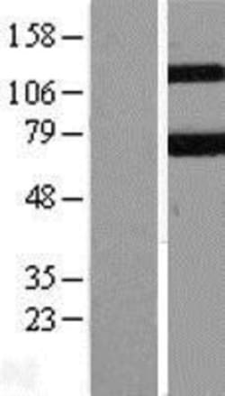 Novus Biologicals&trade;&nbsp;Keap1 Overexpression Lysate