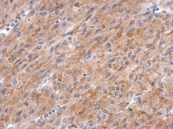 Kelch-Like 3 Antibody, Novus Biologicals 0.1mL; Unlabeled:Antibodies, Polyclonal