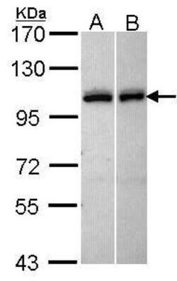 Kell Antibody, Novus Biologicals 0.1 mL | Buy Online | Novus Biologicals | Fisher Scientific