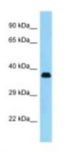 KERA Antibody, Novus Biologicals 20&mu;L; Unlabeled:Antibodies, Polyclonal