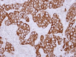 Keratin 36 Antibody, Novus Biologicals 0.1mL; Unlabeled:Antibodies, Polyclonal