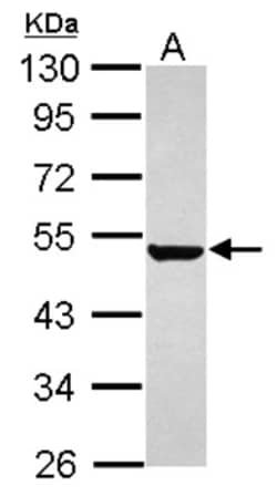 Keratin 36 Antibody, Novus Biologicals 0.1mL; Unlabeled:Antibodies, Polyclonal