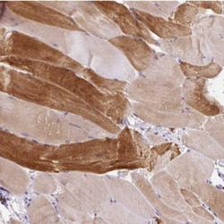 Keratin Associated Protein 20-3 Antibody, Novus Biologicals 0.1mL; Unlabeled:Antibodies,