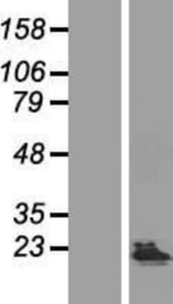 Novus Biologicals&trade;&nbsp;KHDC1 Overexpression Lysate