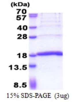 Novus Biologicals Recombinant Human KHDC1L His Protein 0.1 mg | Buy Online | Novus Biologicals&trade; | Fisher Scientific