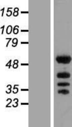 Novus Biologicals&trade;&nbsp;KHDRBS2 Overexpression Lysate