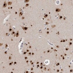KHDRBS2 Antibody, Novus Biologicals 0.1mL; Unlabeled:Antibodies, Polyclonal