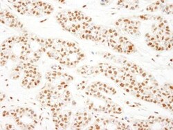 KHSRP Antibody, Novus Biologicals 0.1mL; Unlabeled:Antibodies, Polyclonal