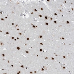 KHSRP Antibody, Novus Biologicals:Antibodies:Primary Antibodies