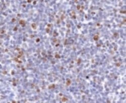 Ki67/MKI67 Antibody - BSA Free, Novus Biologicals:Antibodies:Primary Antibodies