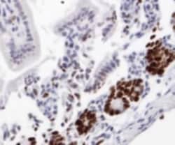 Ki67/MKI67 Antibody - BSA Free, Novus Biologicals:Antibodies:Primary Antibodies