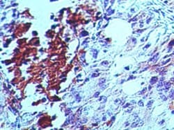 Ki67/MKI67 Antibody, Novus Biologicals:Antibodies:Primary Antibodies