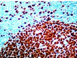 Ki67/MKI67 Antibody (SP6) - Unpurified, Novus Biologicals 0.5mL; Unlabeled:Antibodies,