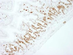 Ki67/MKI67 Antibody - BSA Free, Novus Biologicals:Antibodies:Primary Antibodies
