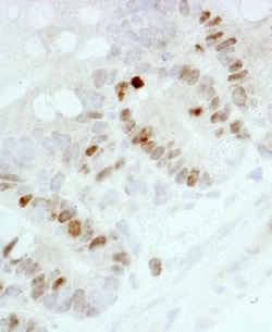 Ki67/MKI67 Antibody - BSA Free, Novus Biologicals:Antibodies:Primary Antibodies