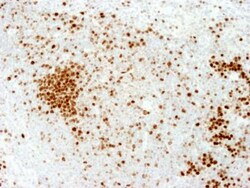 Ki67/MKI67 Antibody - BSA Free, Novus Biologicals:Antibodies:Primary Antibodies
