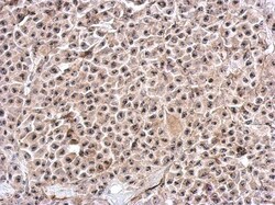 PUM3 Antibody, Novus Biologicals 0.1mL; Unlabeled:Antibodies, Polyclonal