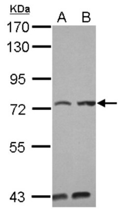 PUM3 Antibody, Novus Biologicals 0.1mL; Unlabeled:Antibodies, Polyclonal