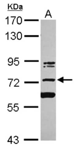 PUM3 Antibody, Novus Biologicals™