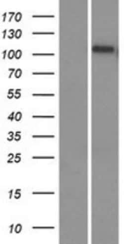 Novus Biologicals™ EMC1 Overexpression Lysate