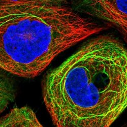 KIAA0232 Antibody, Novus Biologicals 0.1mL; Unlabeled:Antibodies, Polyclonal