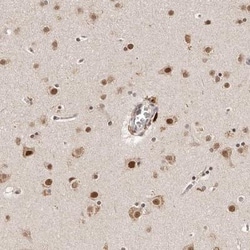 BICRAL Antibody, Novus Biologicals 0.1mL; Unlabeled:Antibodies, Polyclonal