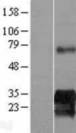 Novus Biologicals&trade;&nbsp;SUSD6 Overexpression Lysate
