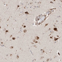 SUSD6 Antibody, Novus Biologicals:Antibodies:Primary Antibodies