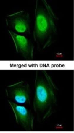 EFCAB14 Antibody, Novus Biologicals 0.1mL; Unlabeled:Antibodies, Polyclonal
