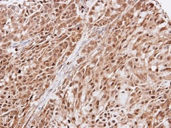 EFCAB14 Antibody, Novus Biologicals 0.1mL; Unlabeled:Antibodies, Polyclonal
