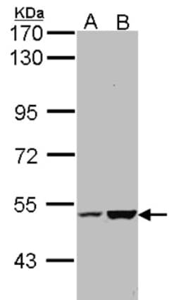 EFCAB14 Antibody, Novus Biologicals 0.1mL; Unlabeled:Antibodies, Polyclonal