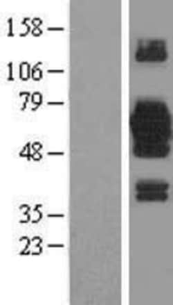 Novus Biologicals&trade;&nbsp;EFCAB14 Overexpression Lysate