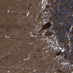 KIAA0513 Antibody, Novus Biologicals 0.1mL; Unlabeled:Antibodies, Polyclonal