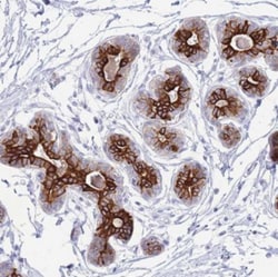 VWA8 Antibody, Novus Biologicals 25 &mu;L, Unlabeled:Antibodies, Polyclonal