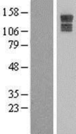 Novus Biologicals&trade;&nbsp;PPP1R26 Overexpression Lysate